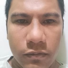 Anthony Ganuelas